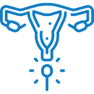Endometriosis