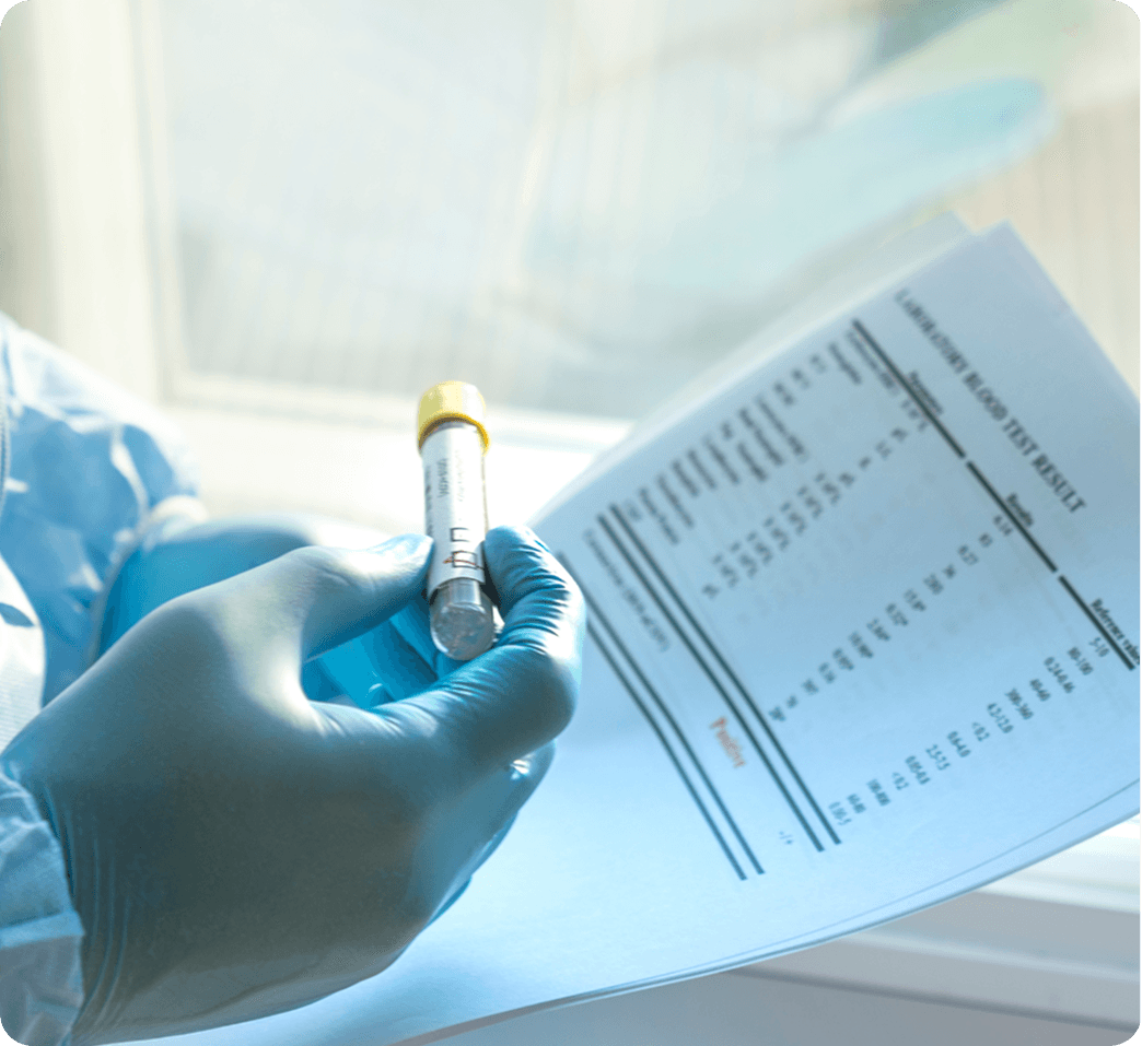 Laboratory blood test
